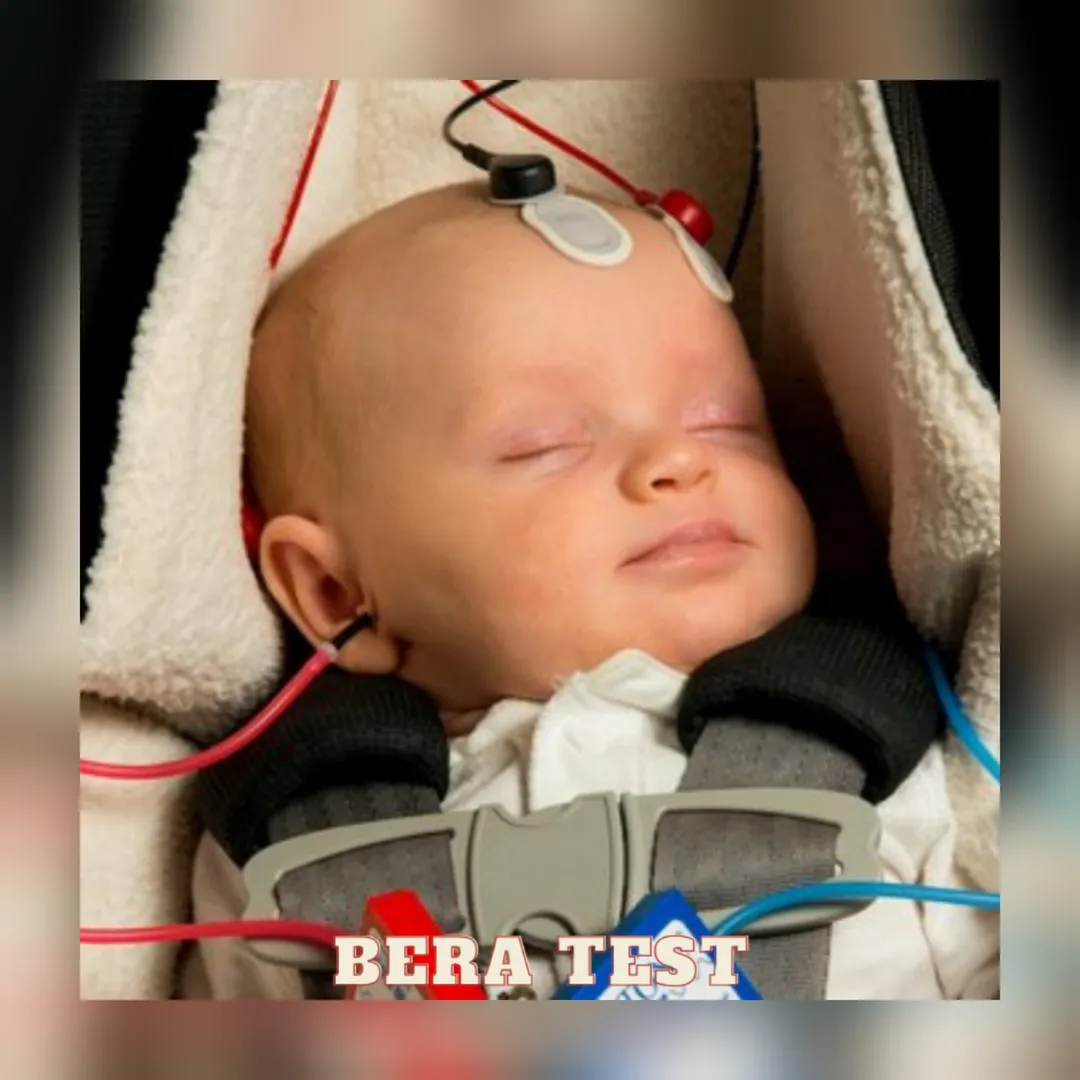 BERA TEST image 2